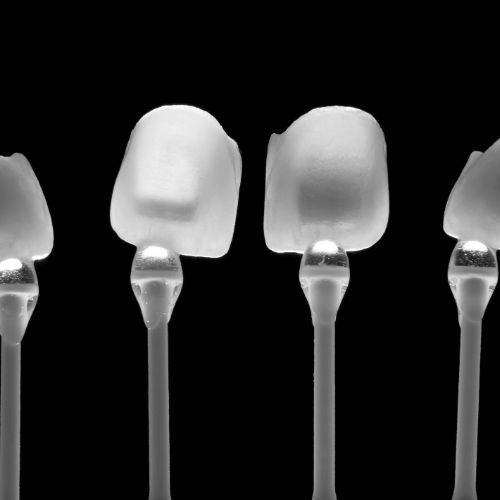 bonding licówki wrocław