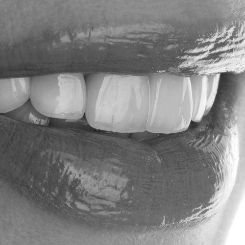 licówki zębowe wrocław