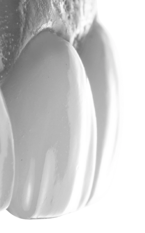 licówki zębowe wrocław