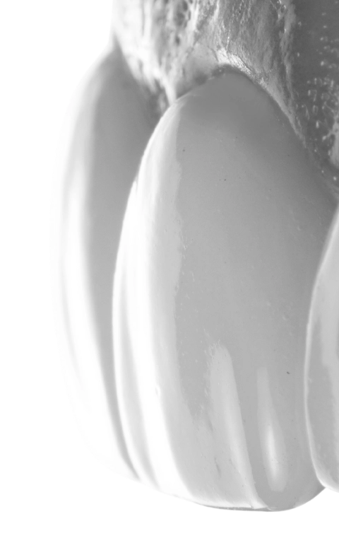 licówki zębowe wrocław